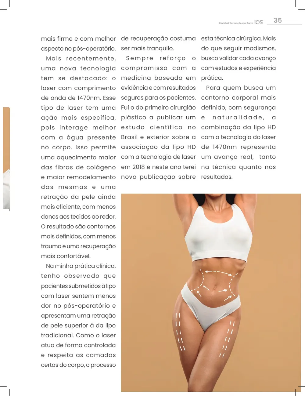 Revista IQS Saúde — Edição 34 — página 35